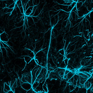 Astrocytes (GFAP immunolabel) in the central nervous system. Image from a study on brain-machine interface neuroinflammation.
Copyright © 2025 Robert "Smitty" Oakes, PhD