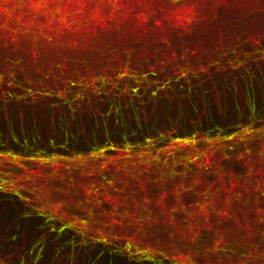 Myelinated (MBP, green) axons (NF200, red) in the central nervous system dentate gyrus. From a study on neuroinflammation and demyelination in models of multiple sclerosis.
Copyright © 2025 Robert "Smitty" Oakes, PhD