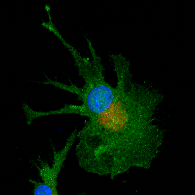 Microglia with surface (IBA1, green), phagocytic compartment (CD68, red), and nucleus (DAPI, blue) labeled. From a study on microglia interactions with astrocyte extracellular matrix.
Copyright © 2025 Robert "Smitty" Oakes, PhD